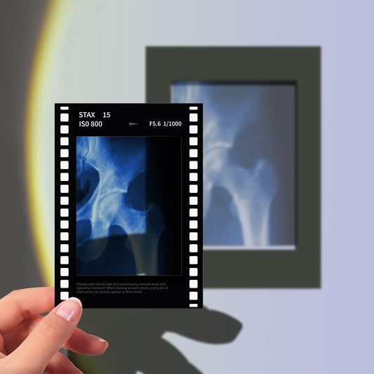 Pelvis X-Ray Film Polaroid