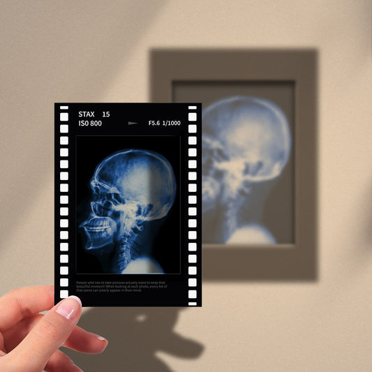 Skull X-Ray Film Polaroid