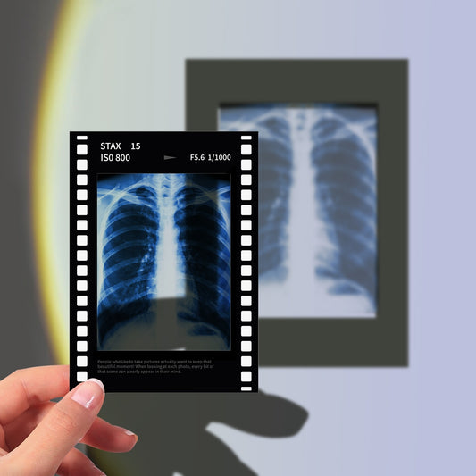 Ribcage X-Ray Film Polaroid