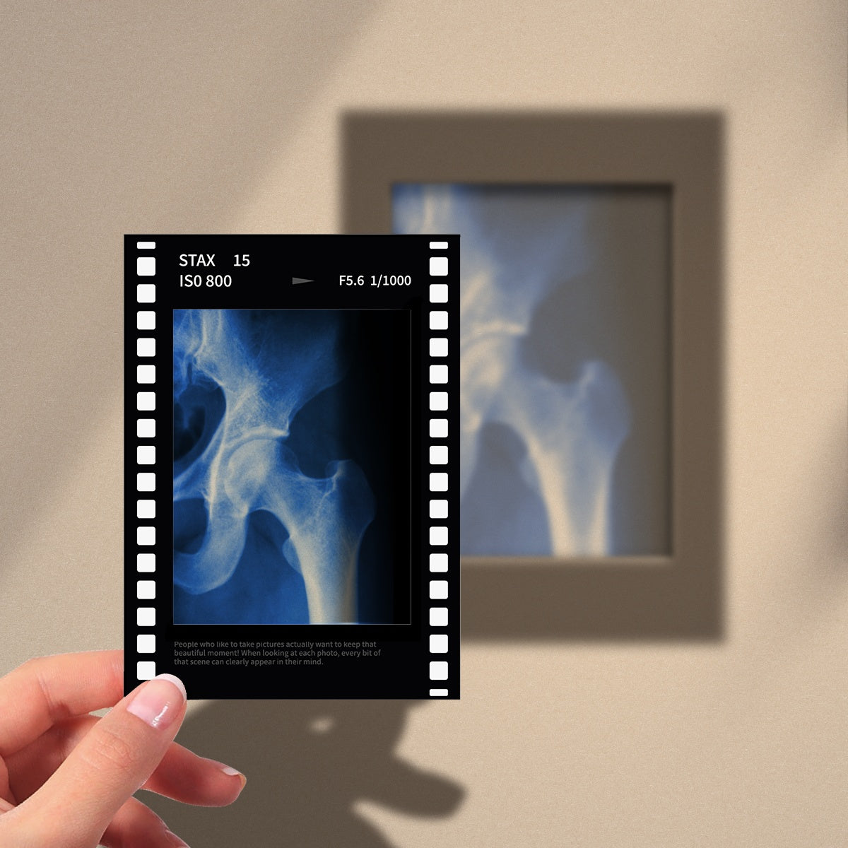 Pelvis X-Ray Film Polaroid