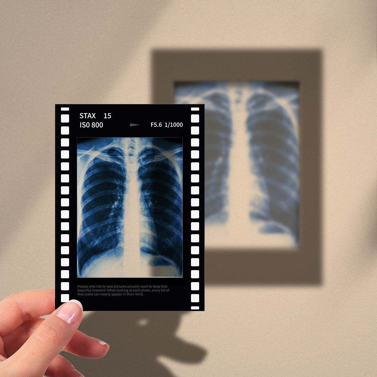 Ribcage X-Ray Film Polaroid