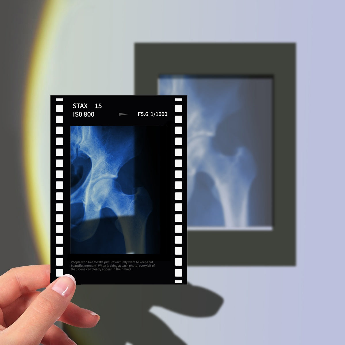 Pelvis X-Ray Film Polaroid